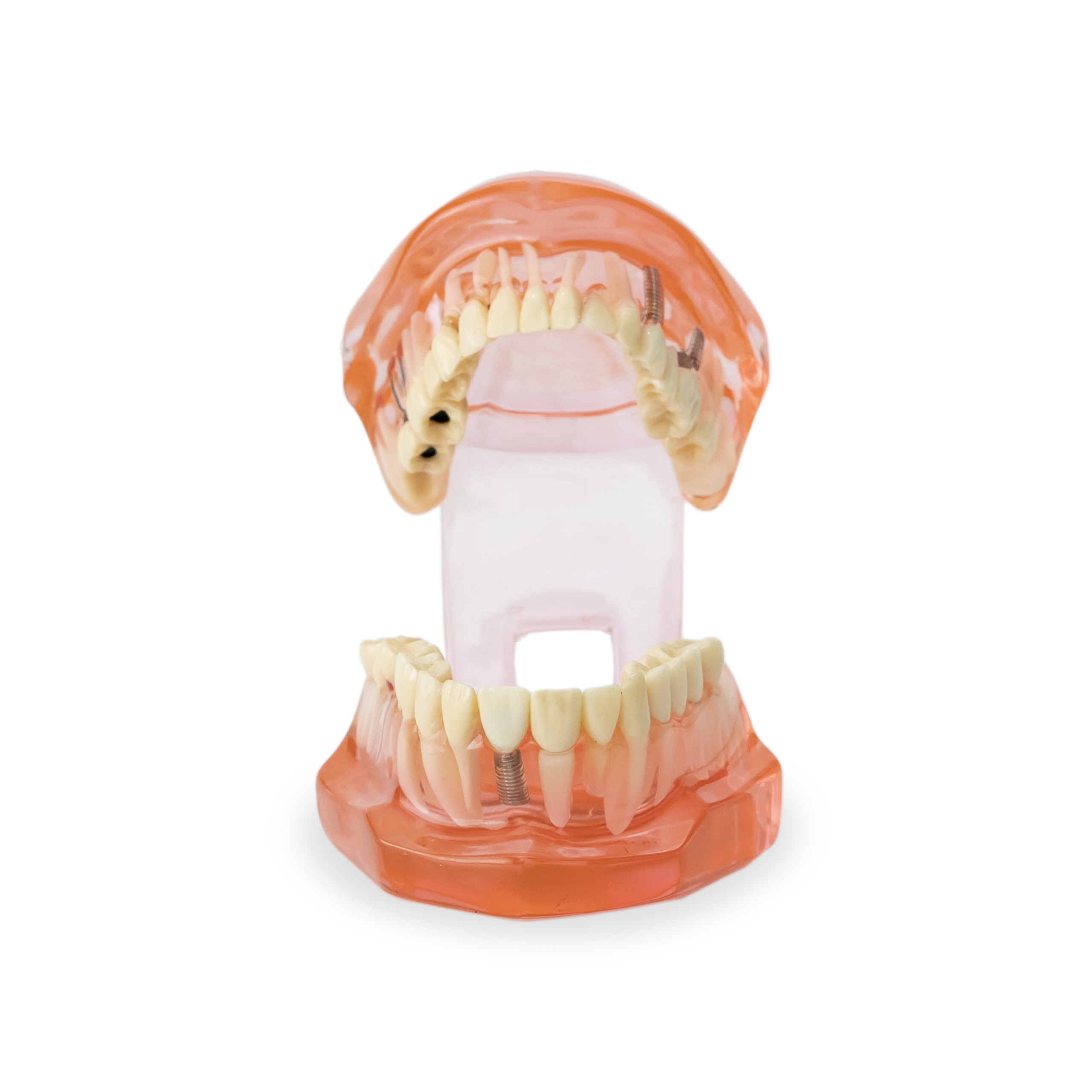 Study Orthodontic Model