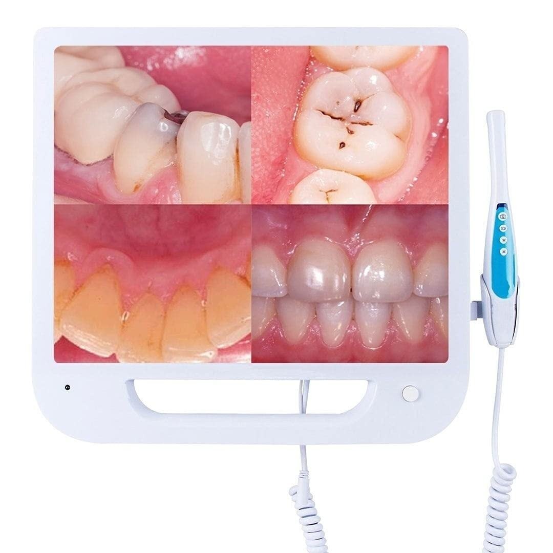 Agkam Intra-Oral Camera