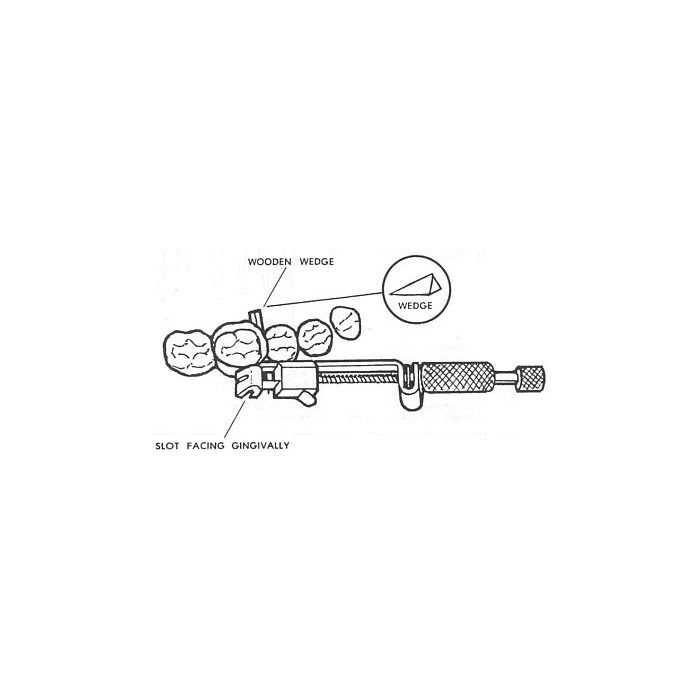 Tofflemire Universal Retainer - Precision