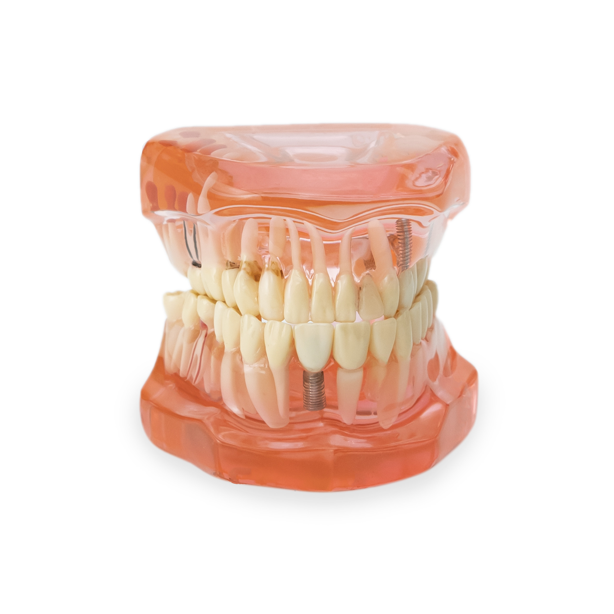 Typhodont Jaw Set  Used In Pre-Clinical Conservative