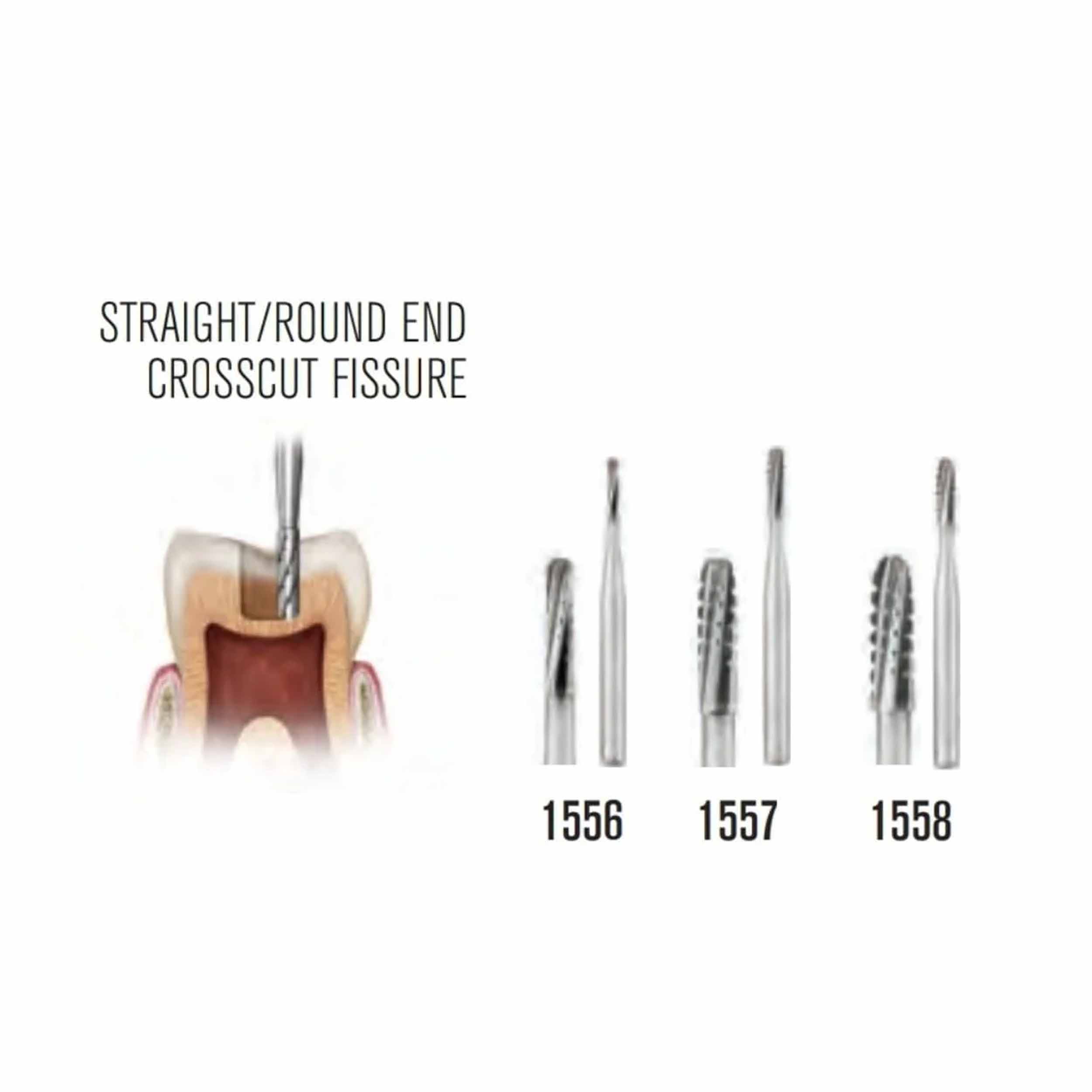 SS White Carbide Burs - Cross Cut Fissure HP 1558