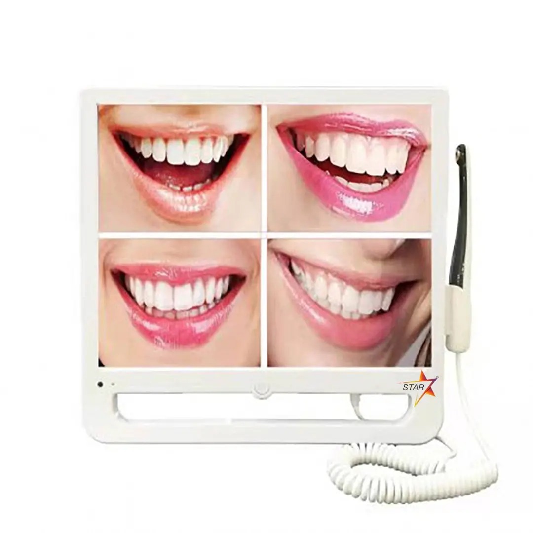 Agkam Intra-Oral Camera